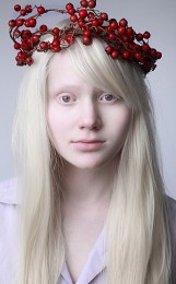 Albino / ***