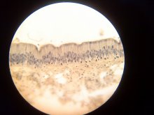 Single-Layer multirowed / ***