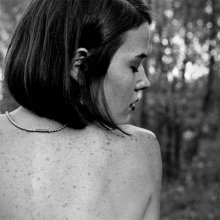 epigastrischen Depression / ***