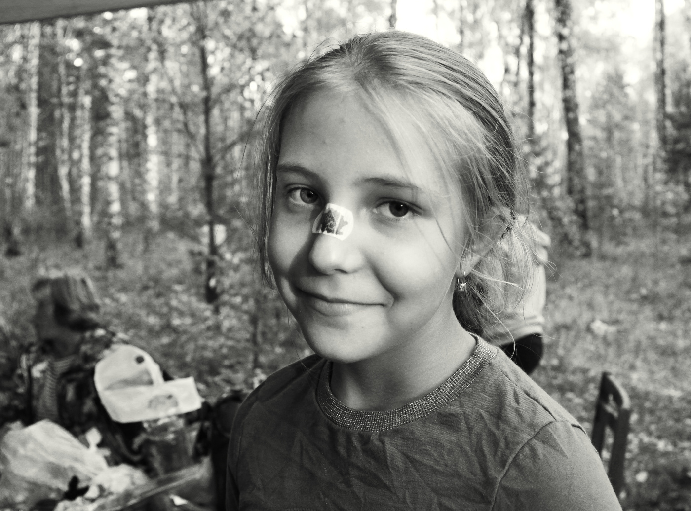 Царапина на носу