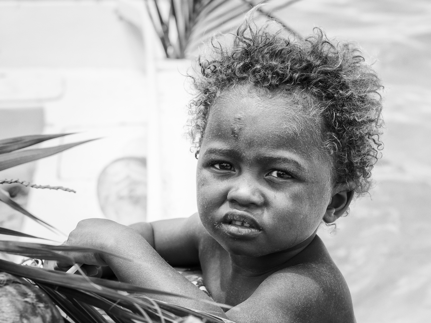 Синдром Маугли